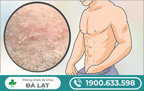 Hình ảnh minh họa